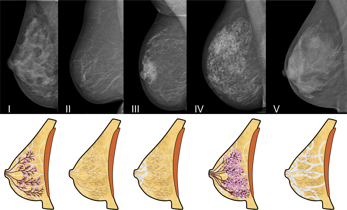 breastcare.patterns